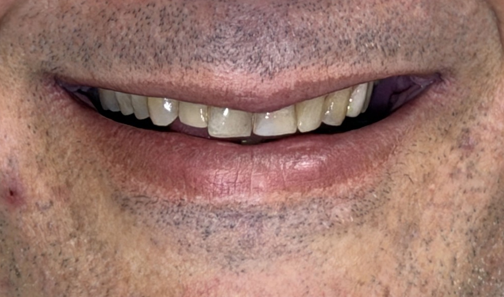 Sorriso antes do tratamento