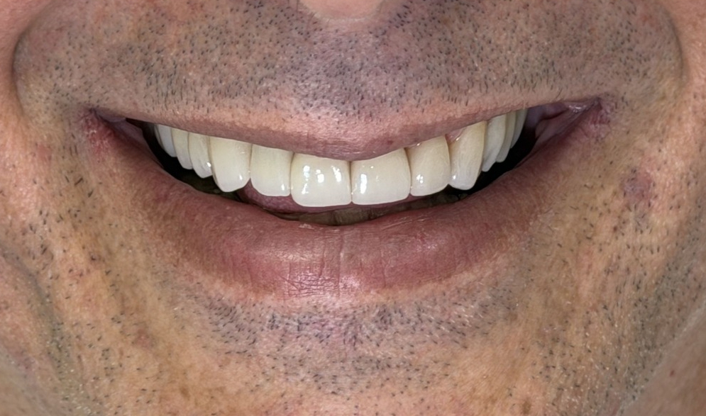 Sorriso depois do tratamento